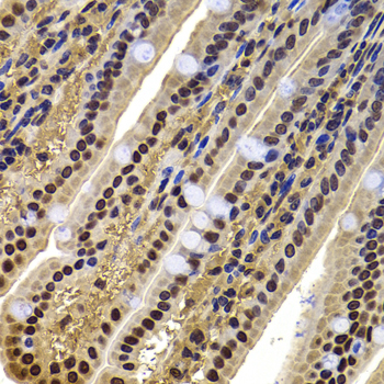 ACTL6B Rabbit polyclonal antibody