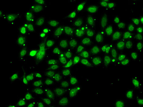 ACTL6B Rabbit polyclonal antibody