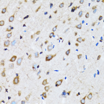 NDE1 Rabbit polyclonal antibody