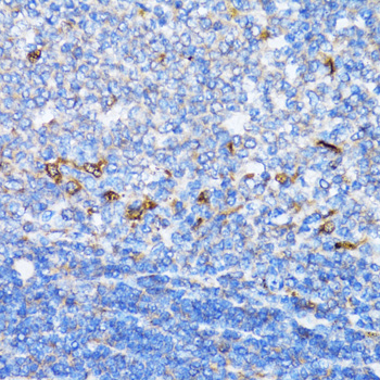NDE1 Rabbit polyclonal antibody