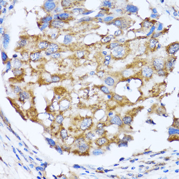 NDE1 Rabbit polyclonal antibody