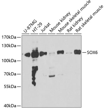 SOX6 Rabbit pAb