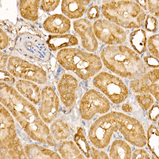 BTNL2 Rabbit polyclonal antibody