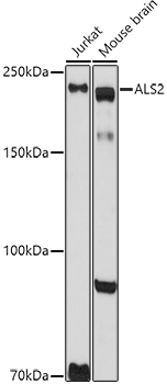 ALS2 Rabbit polyclonal antibody