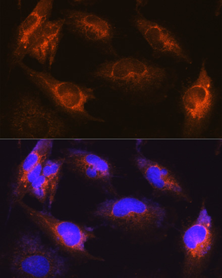 ALS2 Rabbit polyclonal antibody