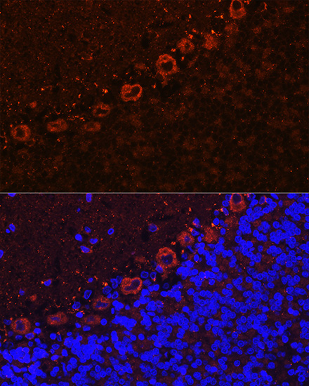 ALS2 Rabbit polyclonal antibody