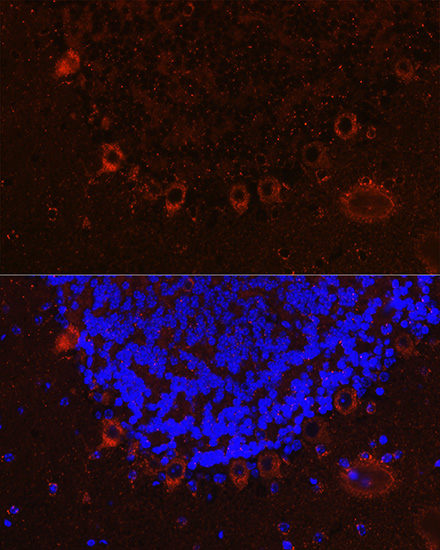 ALS2 Rabbit polyclonal antibody