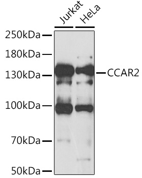 CCAR2 Rabbit polyclonal antibody