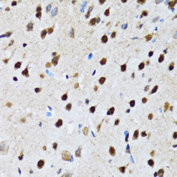 CCAR2 Rabbit polyclonal antibody