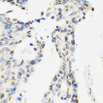 CCAR2 Rabbit polyclonal antibody