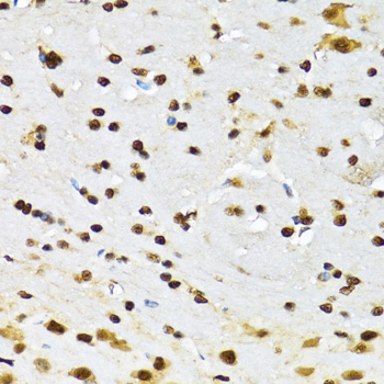 CCAR2 Rabbit polyclonal antibody