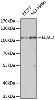 ELAC2 Rabbit polyclonal antibody