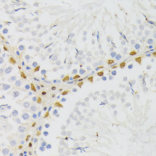ELAC2 Rabbit polyclonal antibody