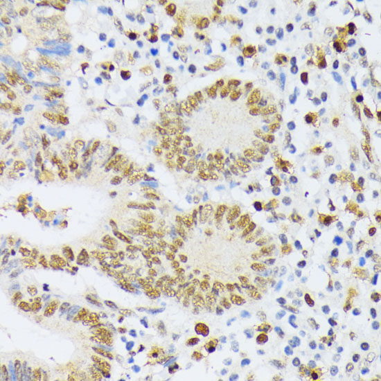 ELAC2 Rabbit polyclonal antibody