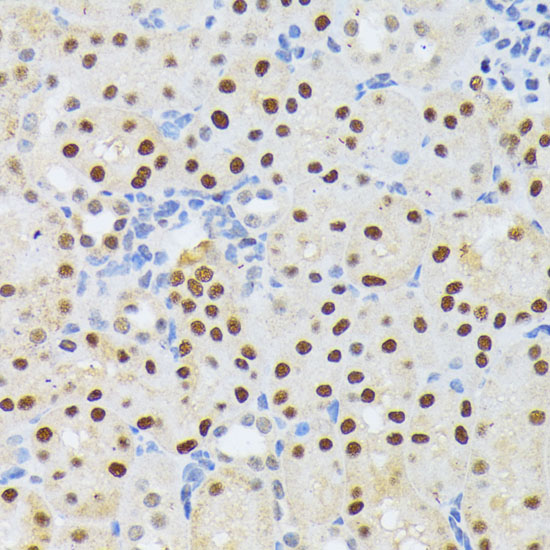 ELAC2 Rabbit polyclonal antibody