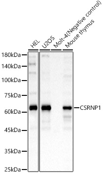 CSRNP1 Rabbit polyclonal antibody