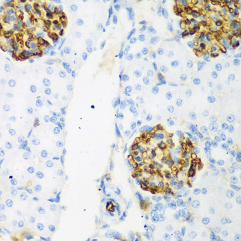 CSRNP1 Rabbit polyclonal antibody