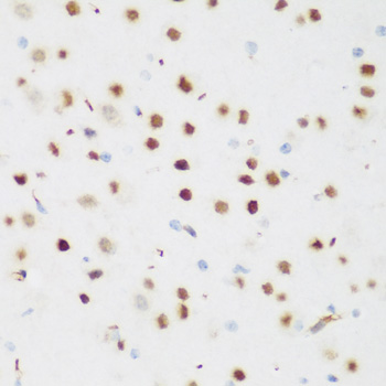 CSRNP1 Rabbit polyclonal antibody