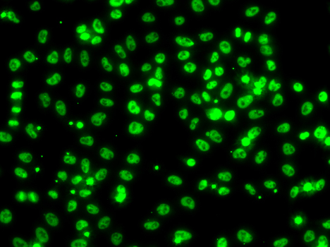 CSRNP1 Rabbit polyclonal antibody