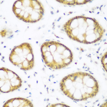 BRD9 Rabbit polyclonal antibody