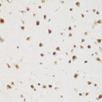 BRD9 Rabbit polyclonal antibody