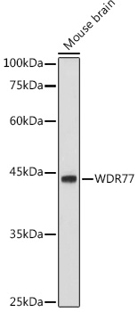 WDR77 Rabbit polyclonal antibody