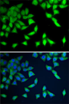 WDR77 Rabbit polyclonal antibody