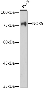 NOX5 Rabbit polyclonal antibody