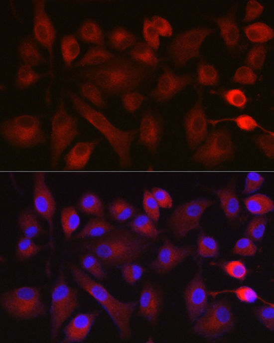 NOX5 Rabbit polyclonal antibody