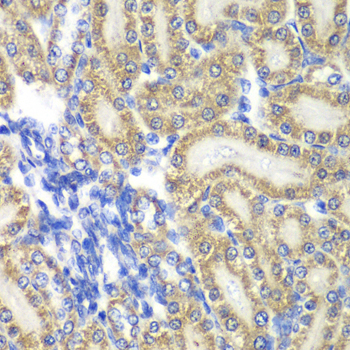 PTGES2 Rabbit polyclonal antibody
