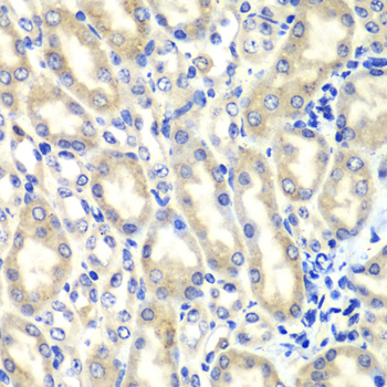 PTGES2 Rabbit polyclonal antibody
