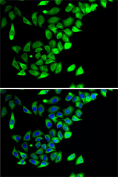 PTGES2 Rabbit polyclonal antibody