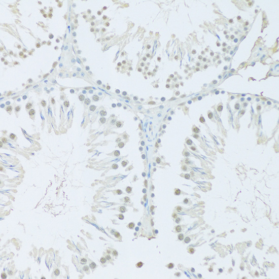FIP1L1 Rabbit polyclonal antibody