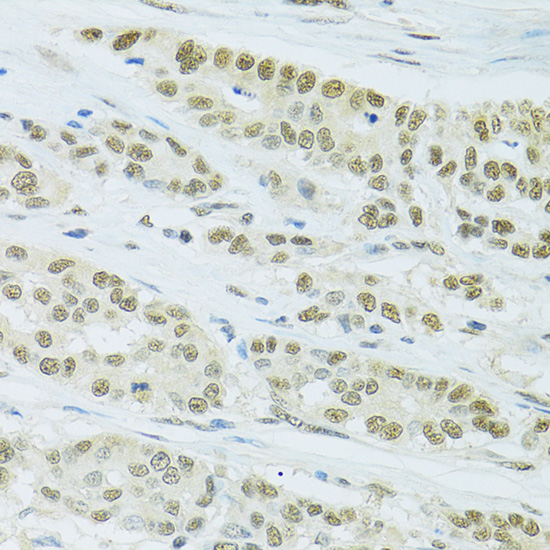 FIP1L1 Rabbit polyclonal antibody