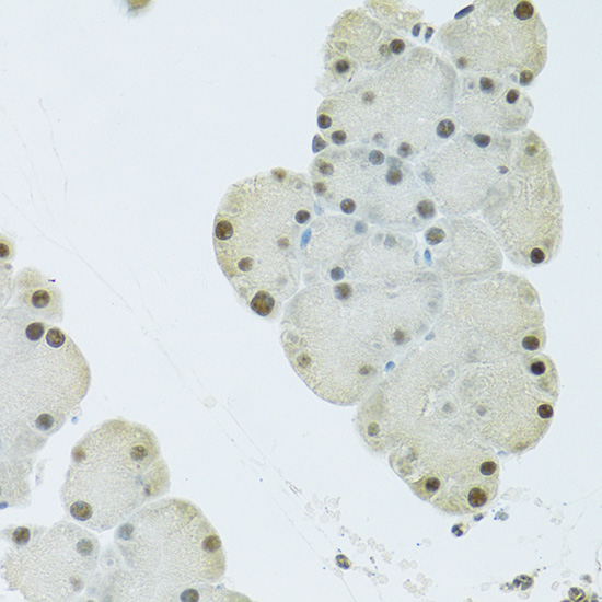 FIP1L1 Rabbit polyclonal antibody