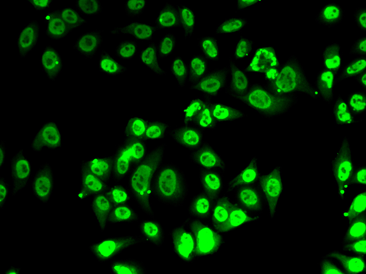 FIP1L1 Rabbit polyclonal antibody