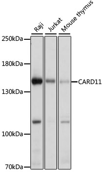 CARD11 Rabbit polyclonal antibody