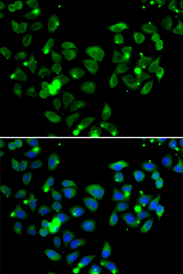 CARD11 Rabbit polyclonal antibody