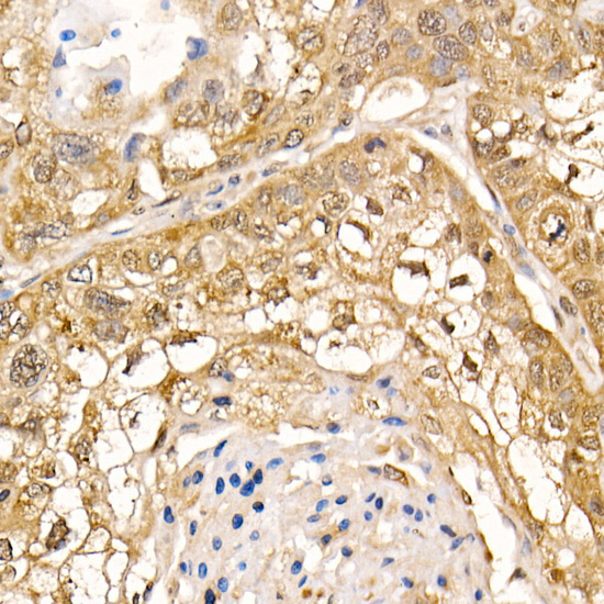 UBASH3B Rabbit polyclonal antibody