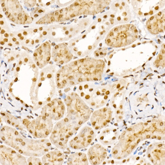 UBASH3B Rabbit polyclonal antibody