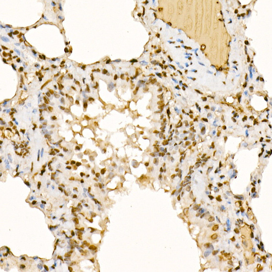 UBASH3B Rabbit polyclonal antibody