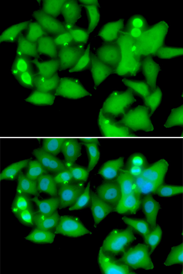 UBASH3B Rabbit polyclonal antibody