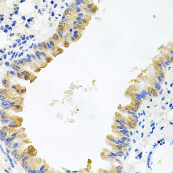 ALKBH8 Rabbit polyclonal antibody