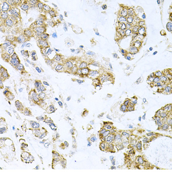 ALKBH8 Rabbit polyclonal antibody