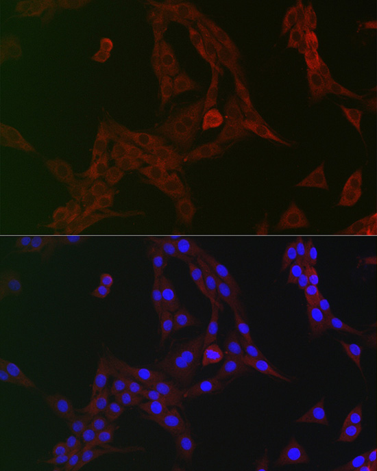 GCN2 Rabbit polyclonal antibody