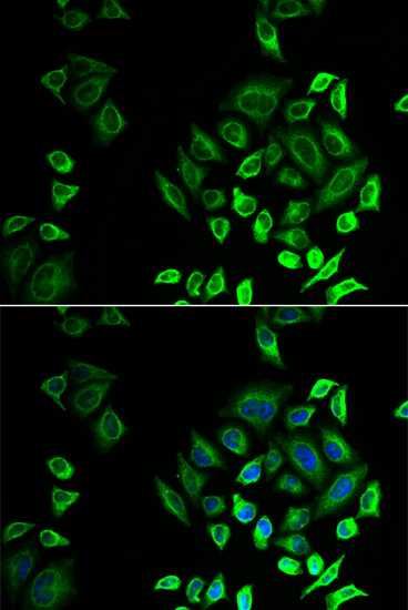 PLA2G2D Rabbit polyclonal antibody