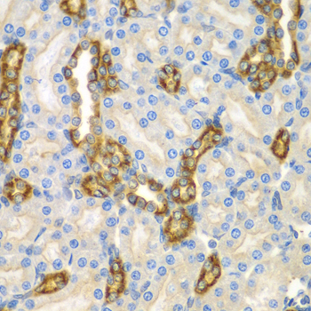 CNPY3 Rabbit polyclonal antibody