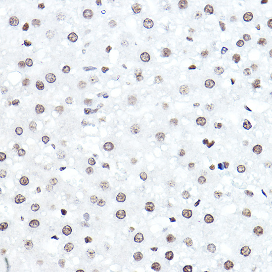 ELF5 Rabbit polyclonal antibody