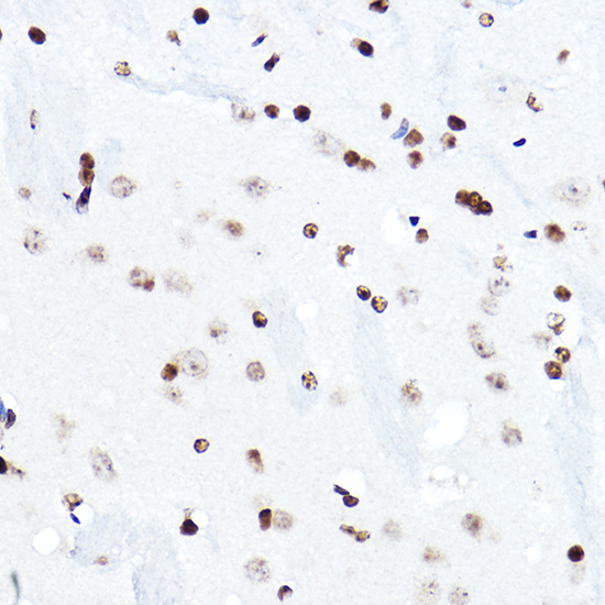 ELF5 Rabbit polyclonal antibody