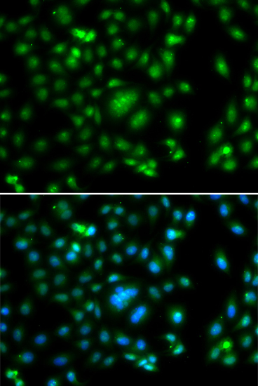 ELF5 Rabbit polyclonal antibody